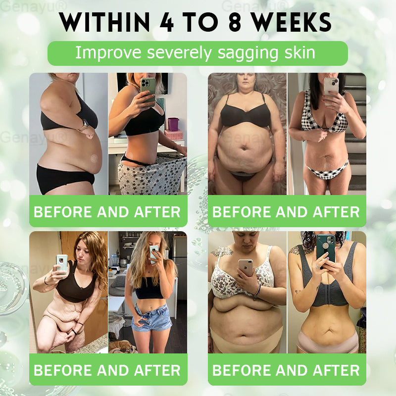 2026 New & Upgraded: 90% OFF ✅ 𝑫𝑶𝑻𝑨𝑳𝑬® Lymphatic Drainage Slimming Nan