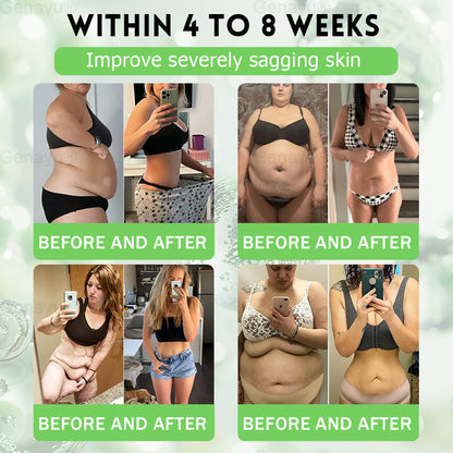 2026 New & Upgraded: 90% OFF ✅ 𝑫𝑶𝑻𝑨𝑳𝑬® Lymphatic Drainage Slimming Nan