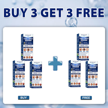 Congratulations! You’re our 500th customer today and qualify for a special offer: get a second Hiskin ® product at 50% OFF!